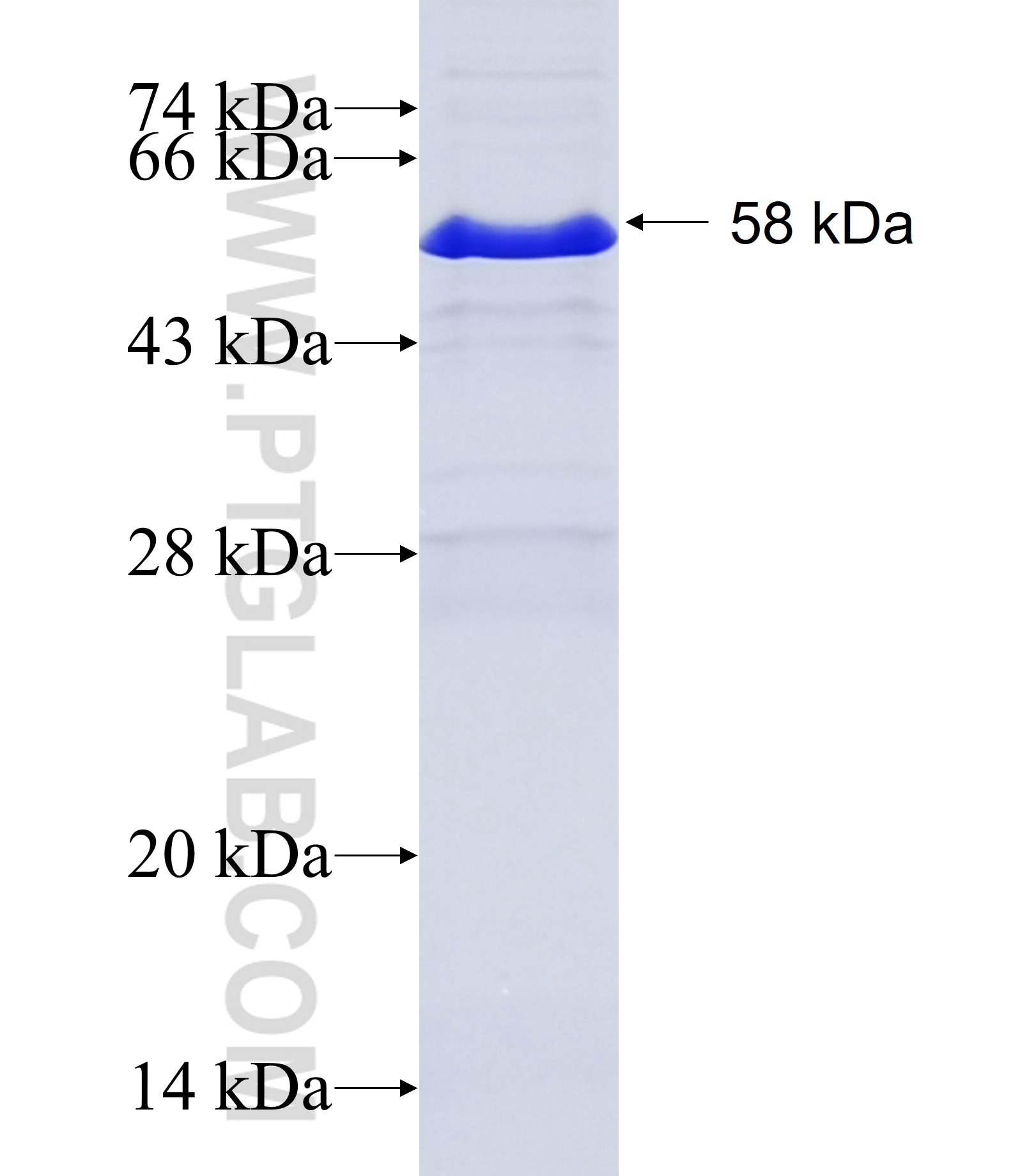 PRSS7 fusion protein Ag27144 SDS-PAGE