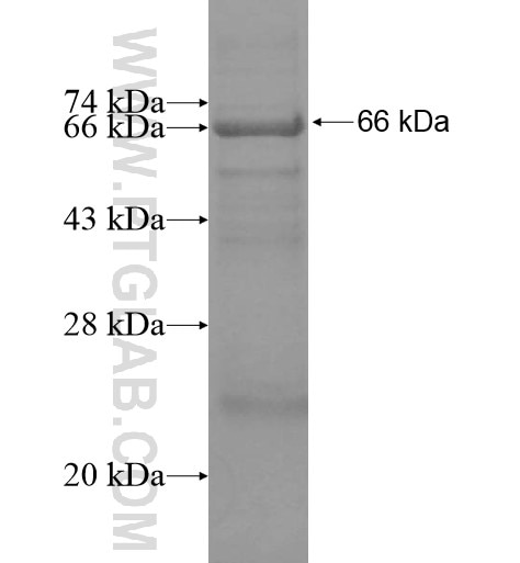 PRSS7 fusion protein Ag15209 SDS-PAGE