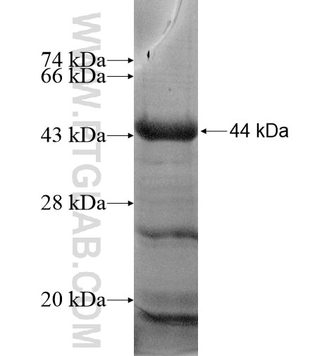 PRSS7 fusion protein Ag15296 SDS-PAGE