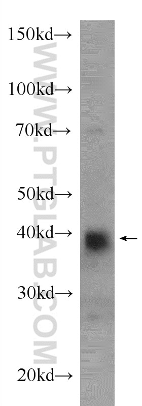 Western Blot (WB) analysis of mouse kidney tissue using PRSS8 Polyclonal antibody (15527-1-AP)