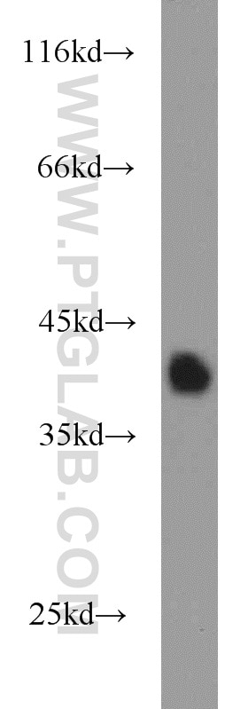 Western Blot (WB) analysis of human colon tissue using PRSS8 Polyclonal antibody (15527-1-AP)