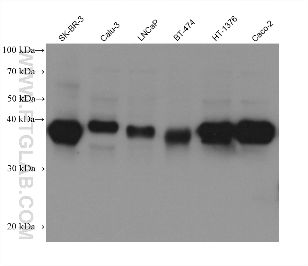 Western Blot (WB) analysis of various lysates using PRSS8 Monoclonal antibody (60912-3-Ig)