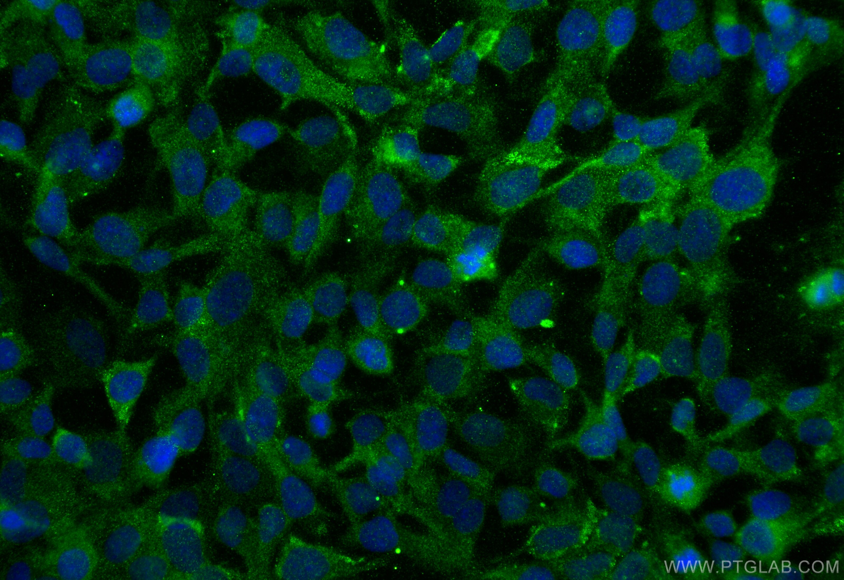 Immunofluorescence (IF) / fluorescent staining of SKOV-3 cells using PRTFDC1 Polyclonal antibody (11986-1-AP)
