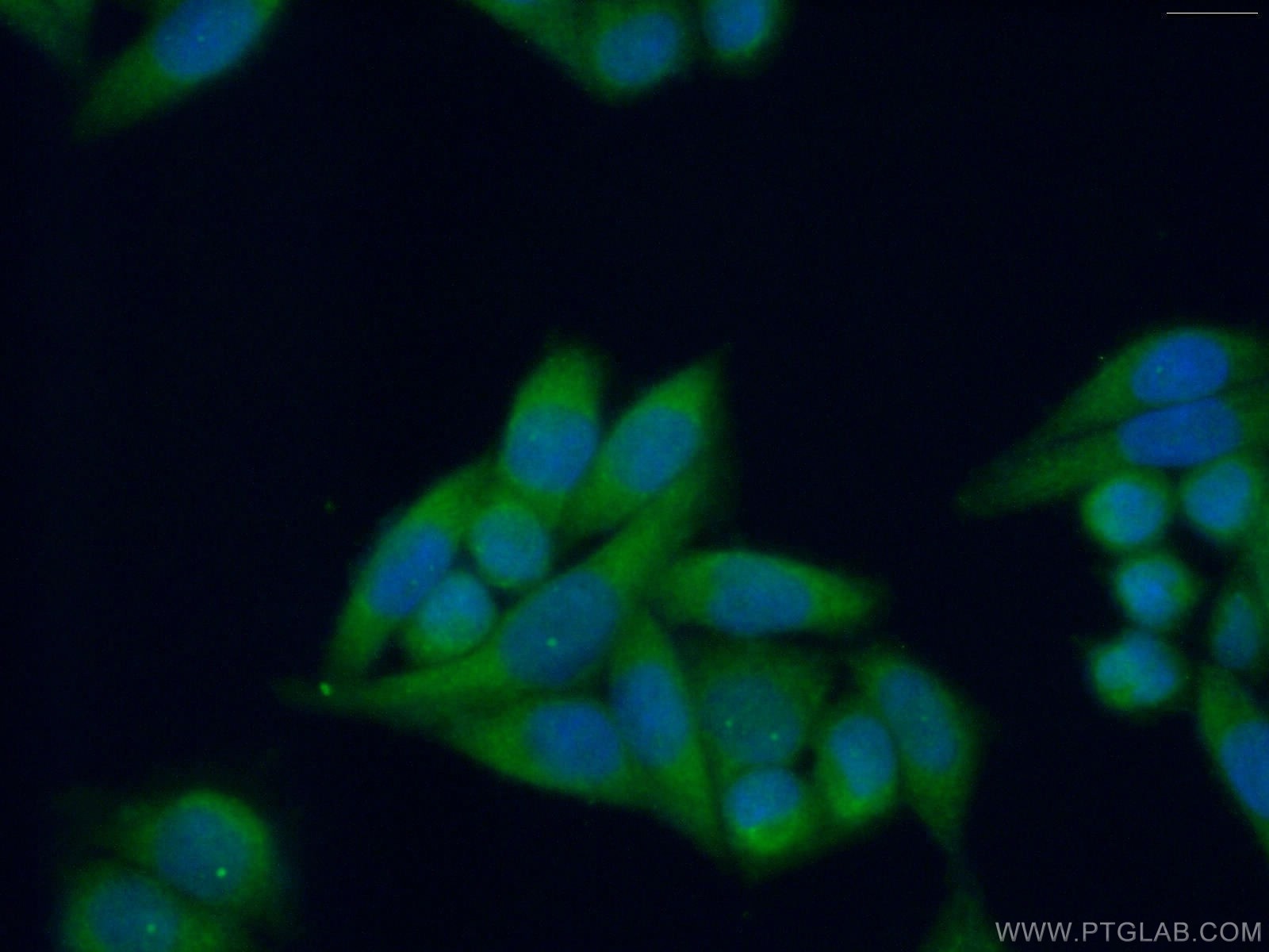 Immunofluorescence (IF) / fluorescent staining of HeLa cells using PRTFDC1 Polyclonal antibody (11986-1-AP)