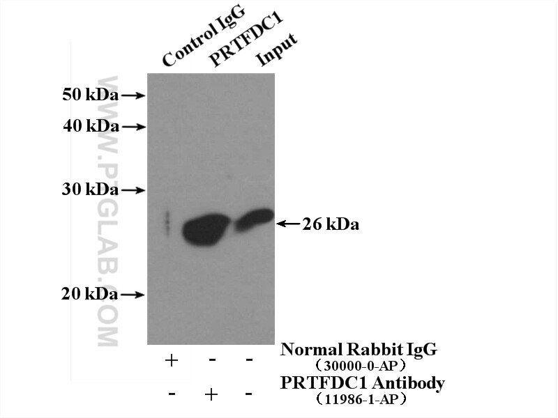 Immunoprecipitation (IP) experiment of mouse brain tissue using PRTFDC1 Polyclonal antibody (11986-1-AP)