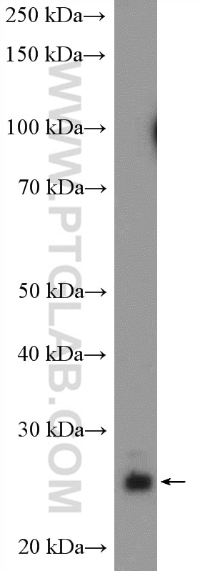 Western Blot (WB) analysis of fetal human brain tissue using PRTFDC1 Polyclonal antibody (11986-1-AP)