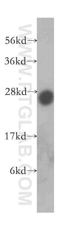 Western Blot (WB) analysis of human brain tissue using PRTFDC1 Polyclonal antibody (11986-1-AP)