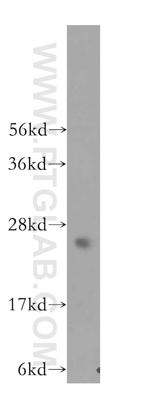 Western Blot (WB) analysis of Y79 cells using PRTFDC1 Polyclonal antibody (11986-1-AP)