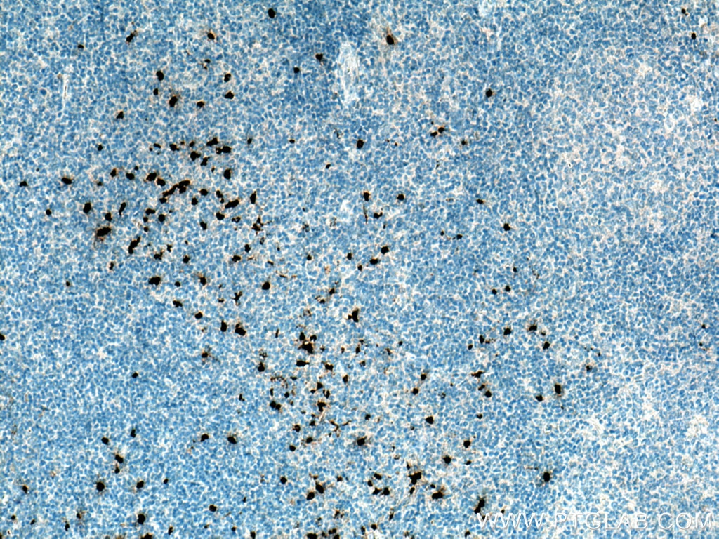 Immunohistochemistry (IHC) staining of human tonsillitis tissue using PRTN3 Polyclonal antibody (25278-1-AP)