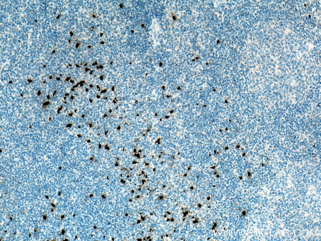 Immunohistochemistry (IHC) staining of human tonsillitis tissue using PRTN3 Polyclonal antibody (25278-1-AP)