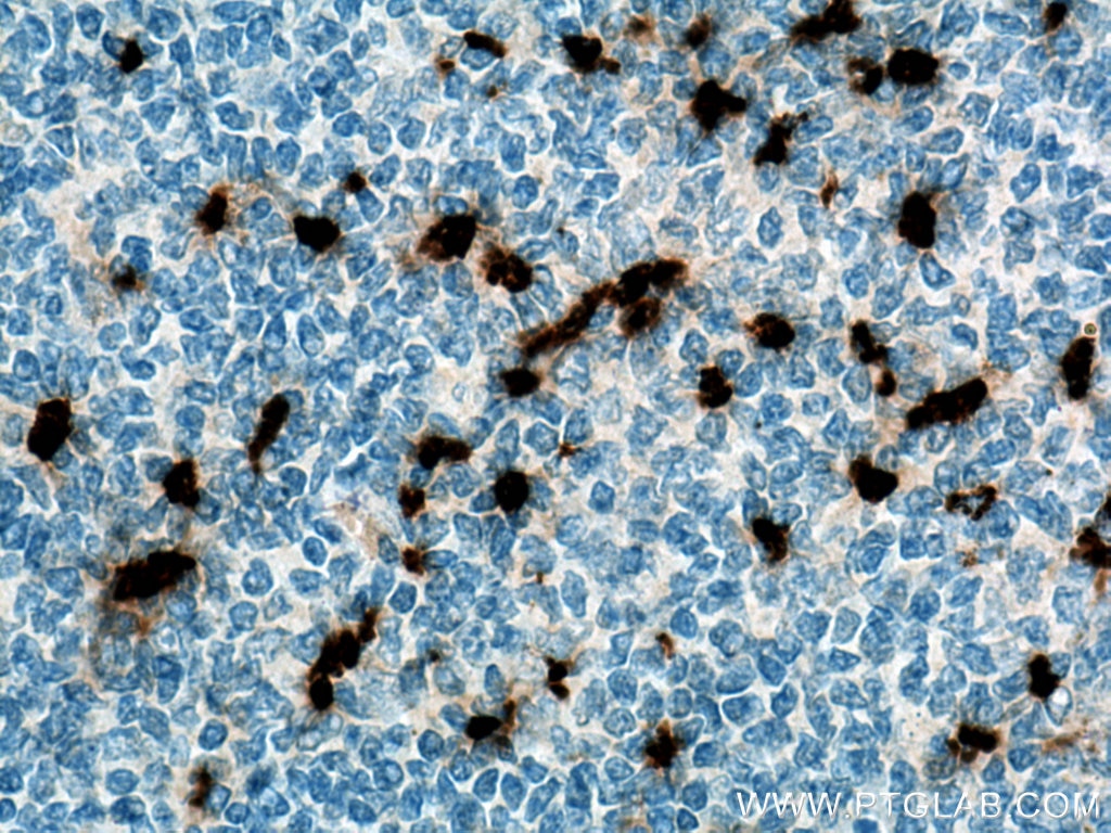 Immunohistochemistry (IHC) staining of human tonsillitis tissue using PRTN3 Polyclonal antibody (25278-1-AP)