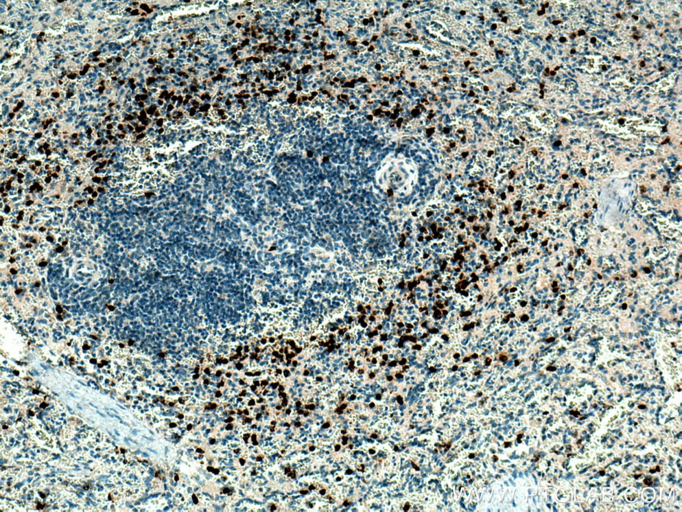 Immunohistochemistry (IHC) staining of human spleen tissue using PRTN3 Polyclonal antibody (25278-1-AP)