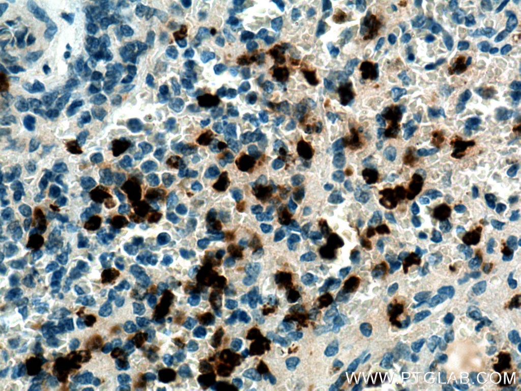 Immunohistochemistry (IHC) staining of human spleen tissue using PRTN3 Polyclonal antibody (25278-1-AP)