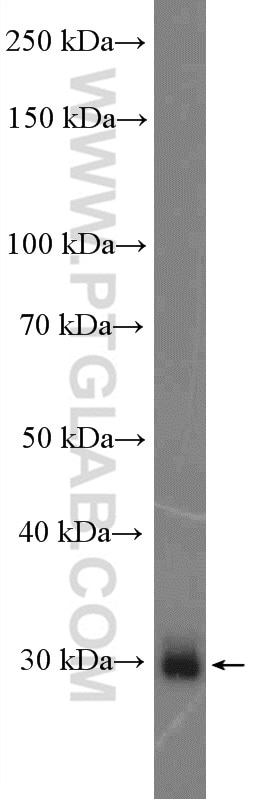 Western Blot (WB) analysis of human placenta tissue using PRTN3 Polyclonal antibody (25278-1-AP)