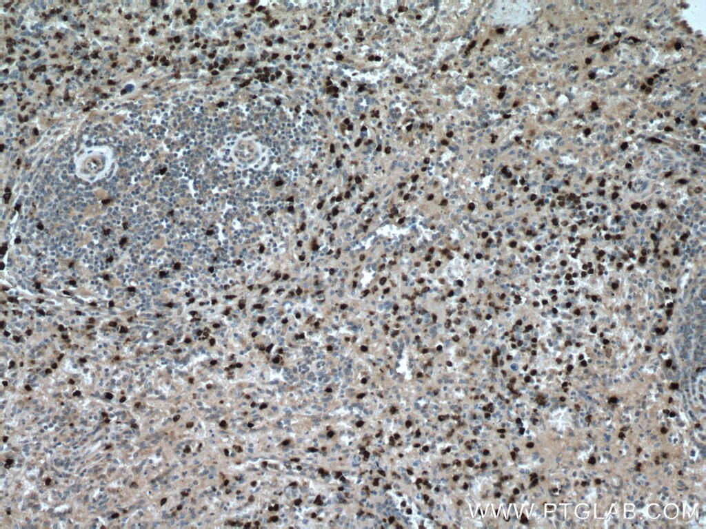 Immunohistochemistry (IHC) staining of human spleen tissue using PRTN3 Polyclonal antibody (27153-1-AP)