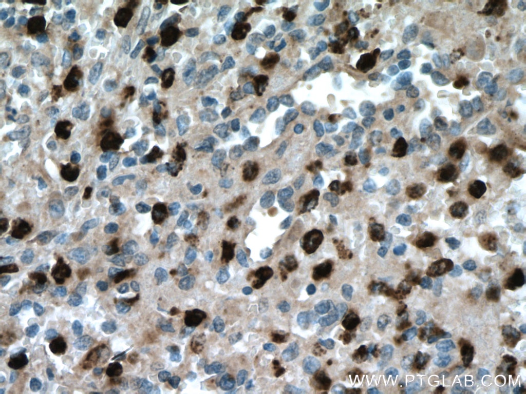 Immunohistochemistry (IHC) staining of human spleen tissue using PRTN3 Polyclonal antibody (27153-1-AP)