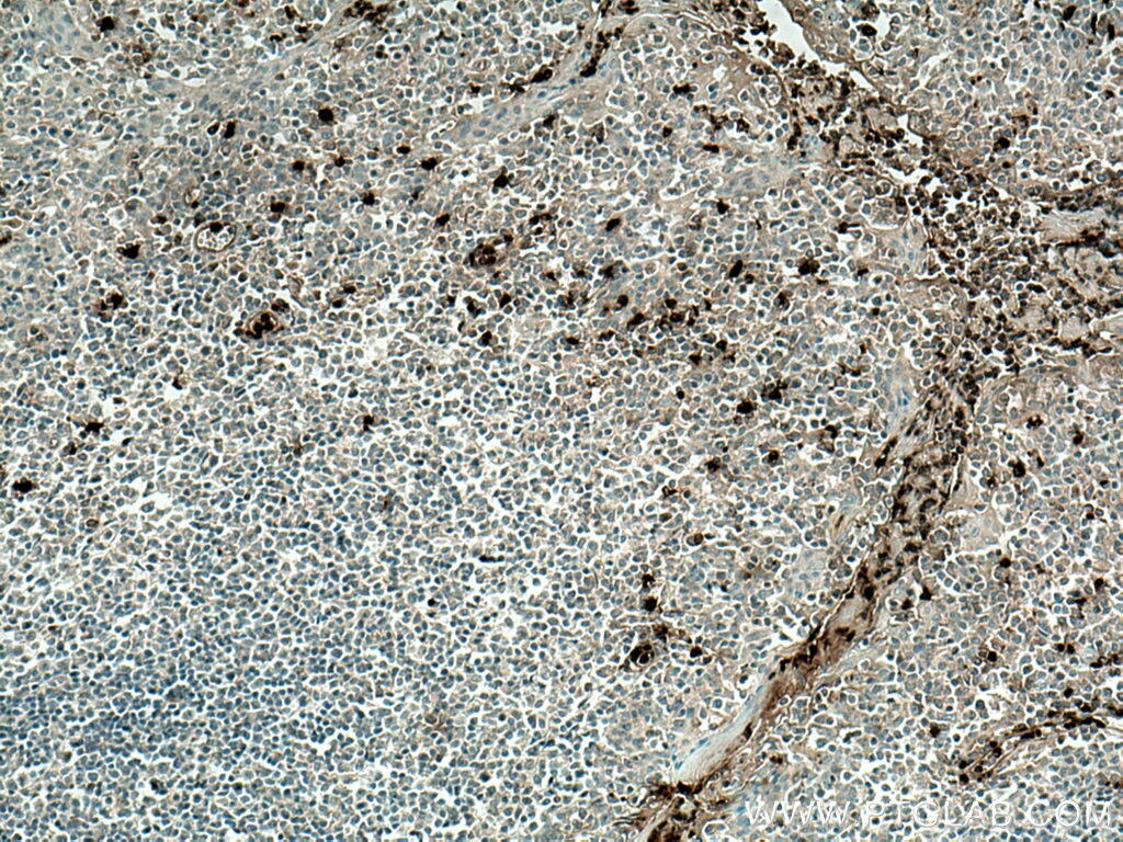 Immunohistochemistry (IHC) staining of human tonsillitis tissue using PRTN3 Polyclonal antibody (27153-1-AP)