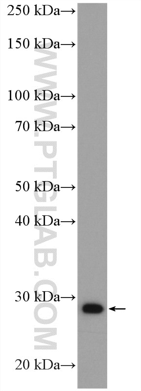 Western Blot (WB) analysis of human placenta tissue using PRTN3 Polyclonal antibody (27153-1-AP)