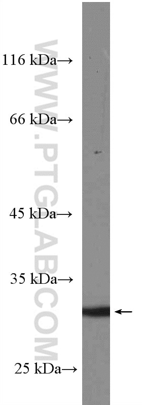 Western Blot (WB) analysis of human spleen tissue using PRTN3 Polyclonal antibody (27153-1-AP)