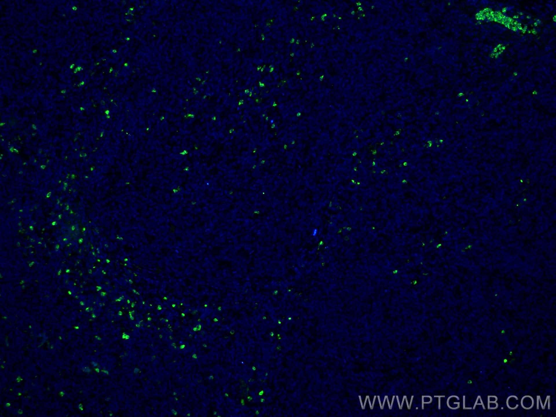 Immunofluorescence (IF) / fluorescent staining of human tonsillitis tissue using PRTN3 Monoclonal antibody (67030-1-Ig)
