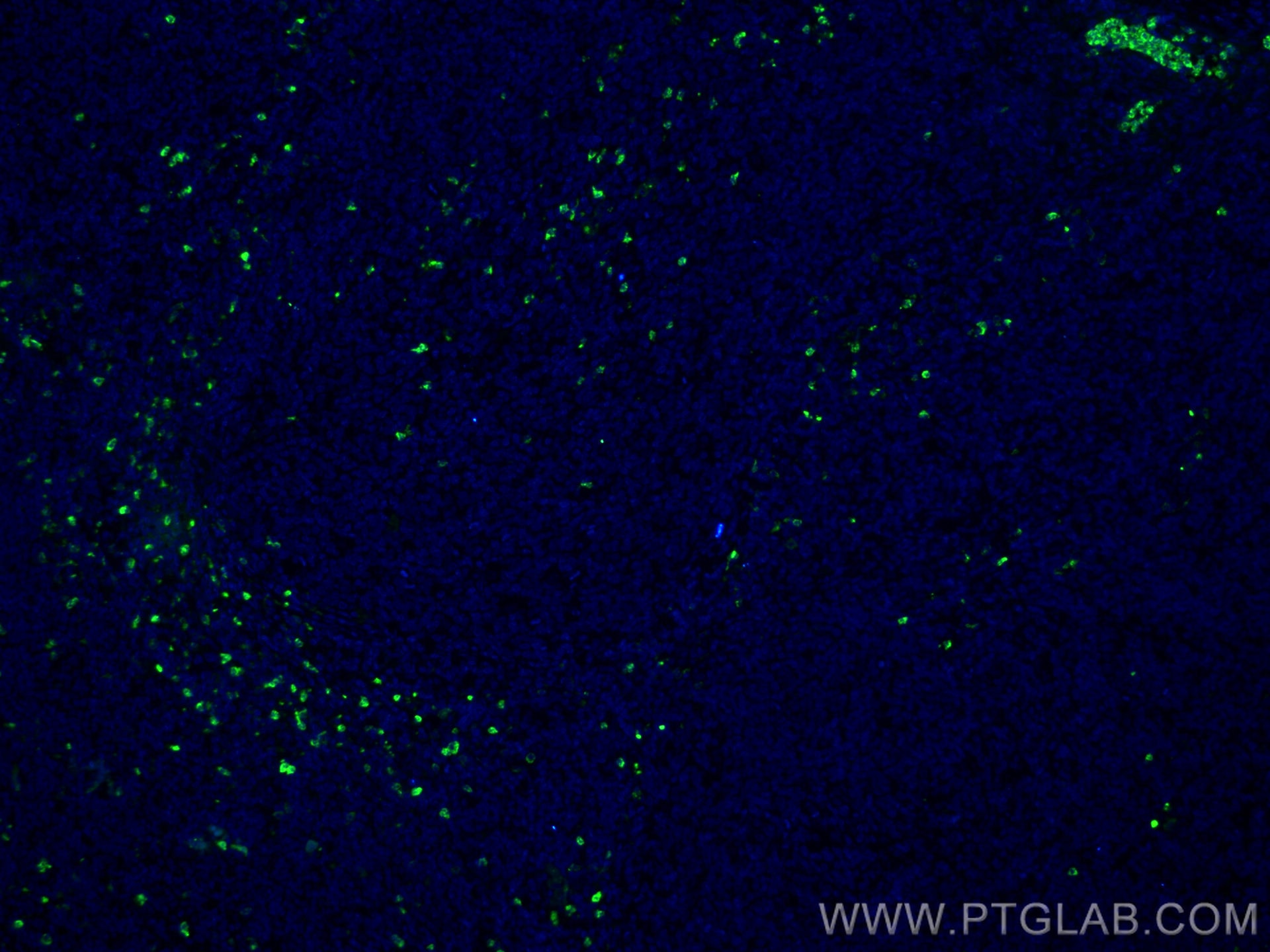 Immunofluorescence (IF) / fluorescent staining of human tonsillitis tissue using PR3/PRTN3 Monoclonal antibody (67030-1-Ig)