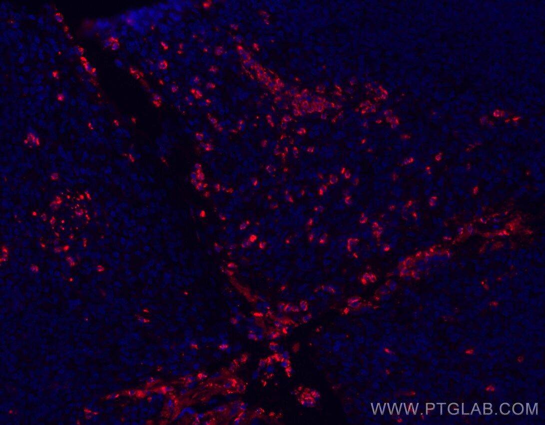 Immunofluorescence (IF) / fluorescent staining of human tonsillitis tissue using PR3/PRTN3 Monoclonal antibody (67030-1-Ig)