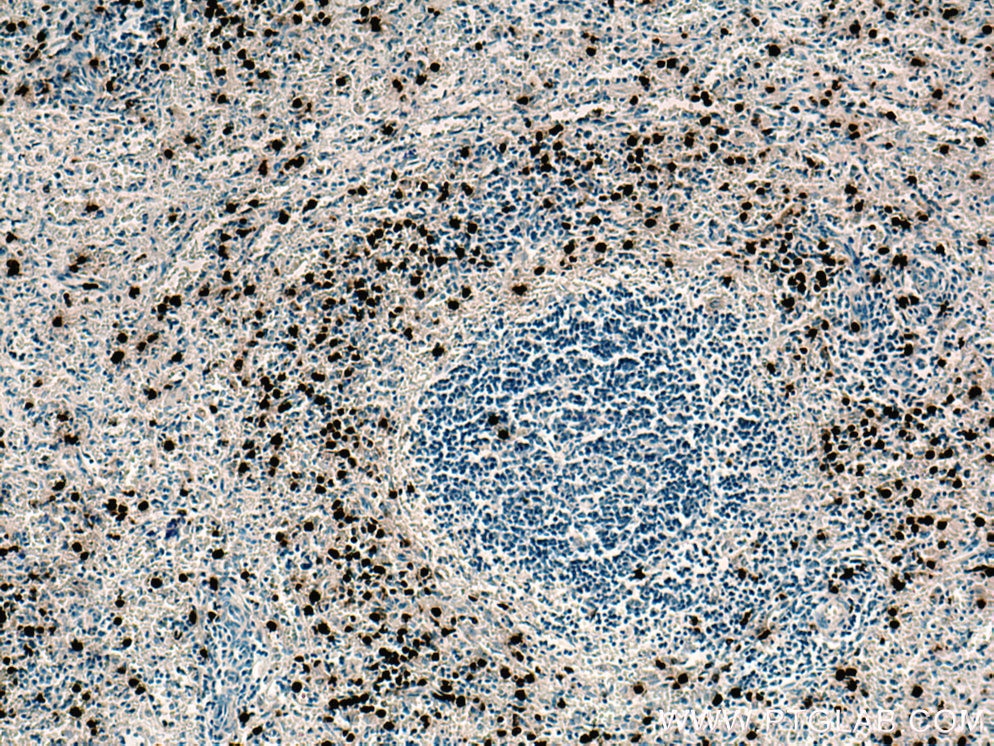 Immunohistochemistry (IHC) staining of human spleen tissue using PR3/PRTN3 Monoclonal antibody (67030-1-Ig)