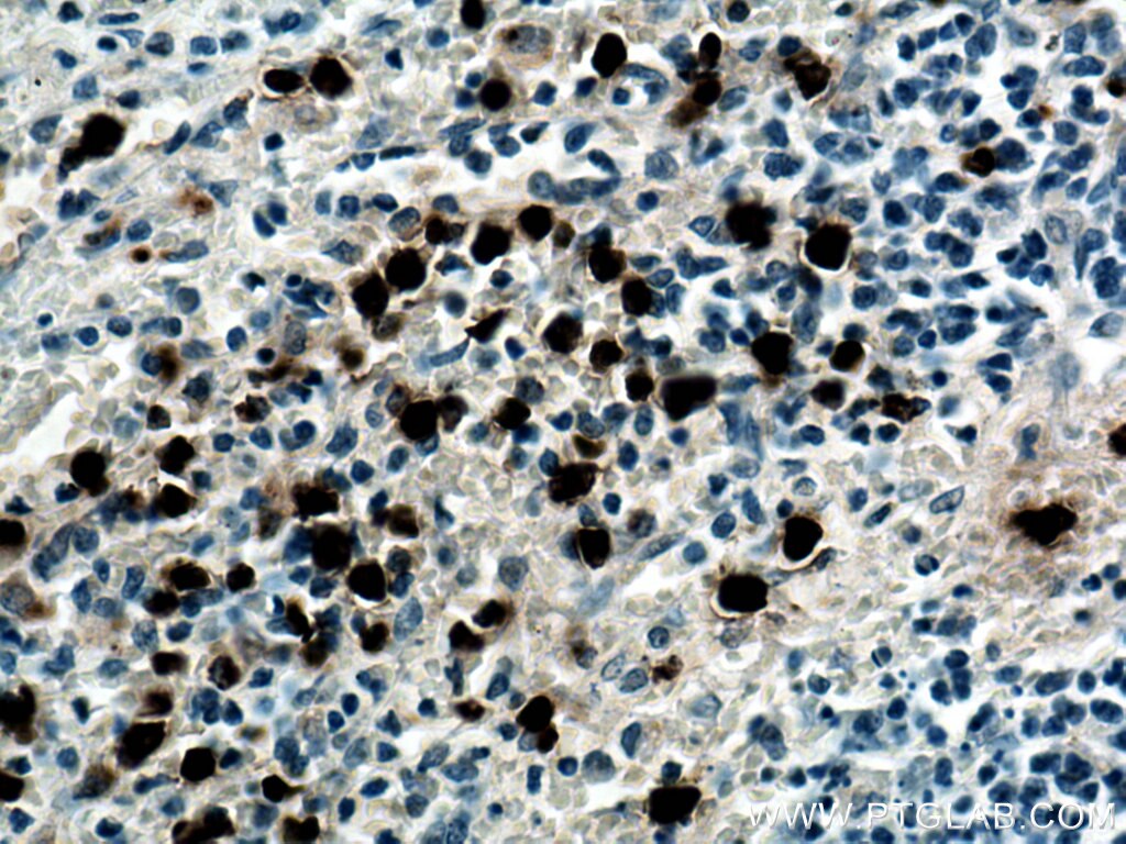 Immunohistochemistry (IHC) staining of human spleen tissue using PRTN3 Monoclonal antibody (67030-1-Ig)