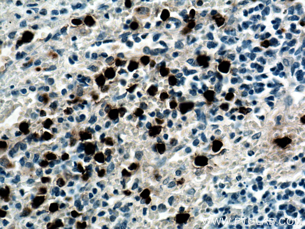 IHC staining of human spleen using 67030-1-Ig