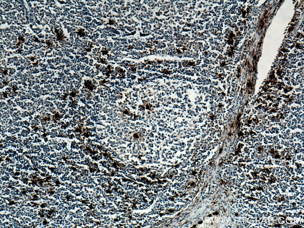 Immunohistochemistry (IHC) staining of human tonsillitis tissue using PRTN3 Monoclonal antibody (67030-1-Ig)