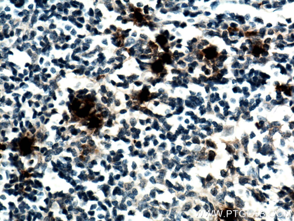 IHC staining of human tonsillitis using 67030-1-Ig