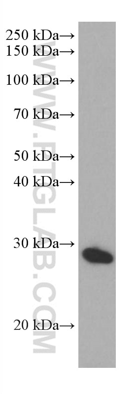 Western Blot (WB) analysis of human placenta tissue using PR3/PRTN3 Monoclonal antibody (67030-1-Ig)