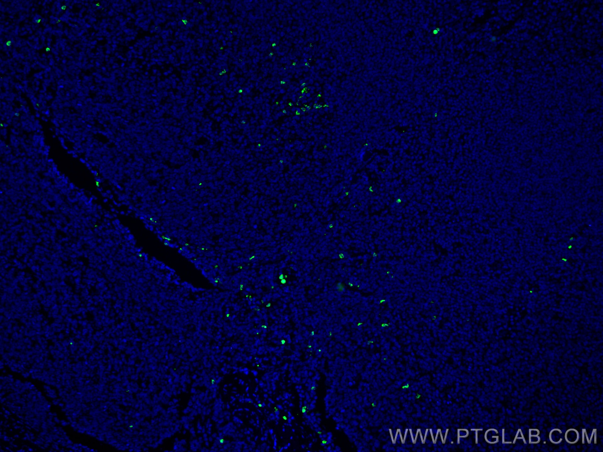 Immunofluorescence (IF) / fluorescent staining of human tonsillitis tissue using CoraLite® Plus 488-conjugated PRTN3 Monoclonal ant (CL488-67030)