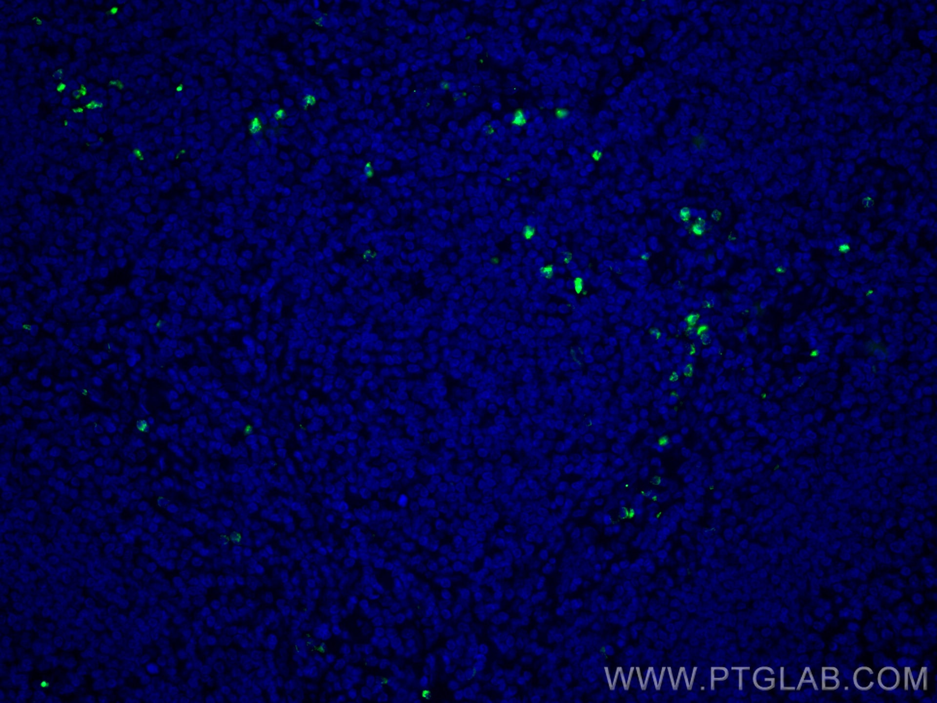 Immunofluorescence (IF) / fluorescent staining of human tonsillitis tissue using CoraLite® Plus 488-conjugated PRTN3 Monoclonal ant (CL488-67030)
