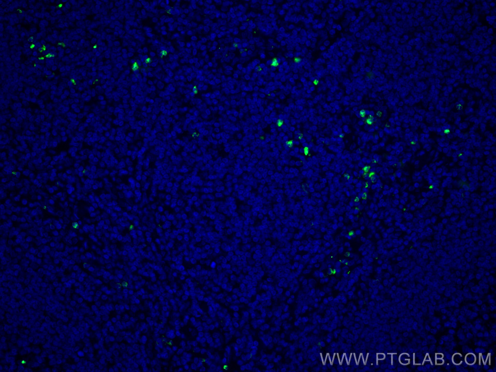 Immunofluorescence (IF) / fluorescent staining of human tonsillitis tissue using CoraLite® Plus 488-conjugated PRTN3 Monoclonal ant (CL488-67030)