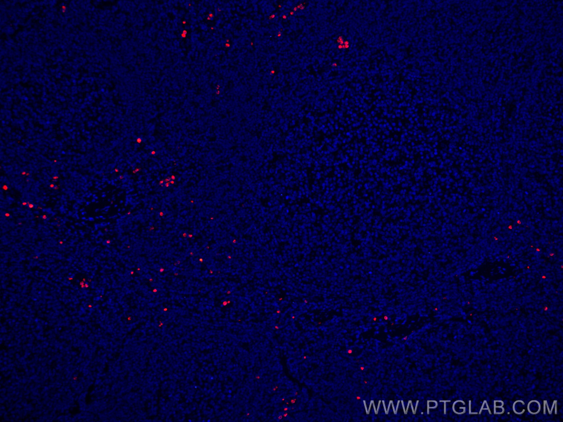 Immunofluorescence (IF) / fluorescent staining of human tonsillitis tissue using CoraLite®594-conjugated PRTN3 Monoclonal antibody (CL594-67030)
