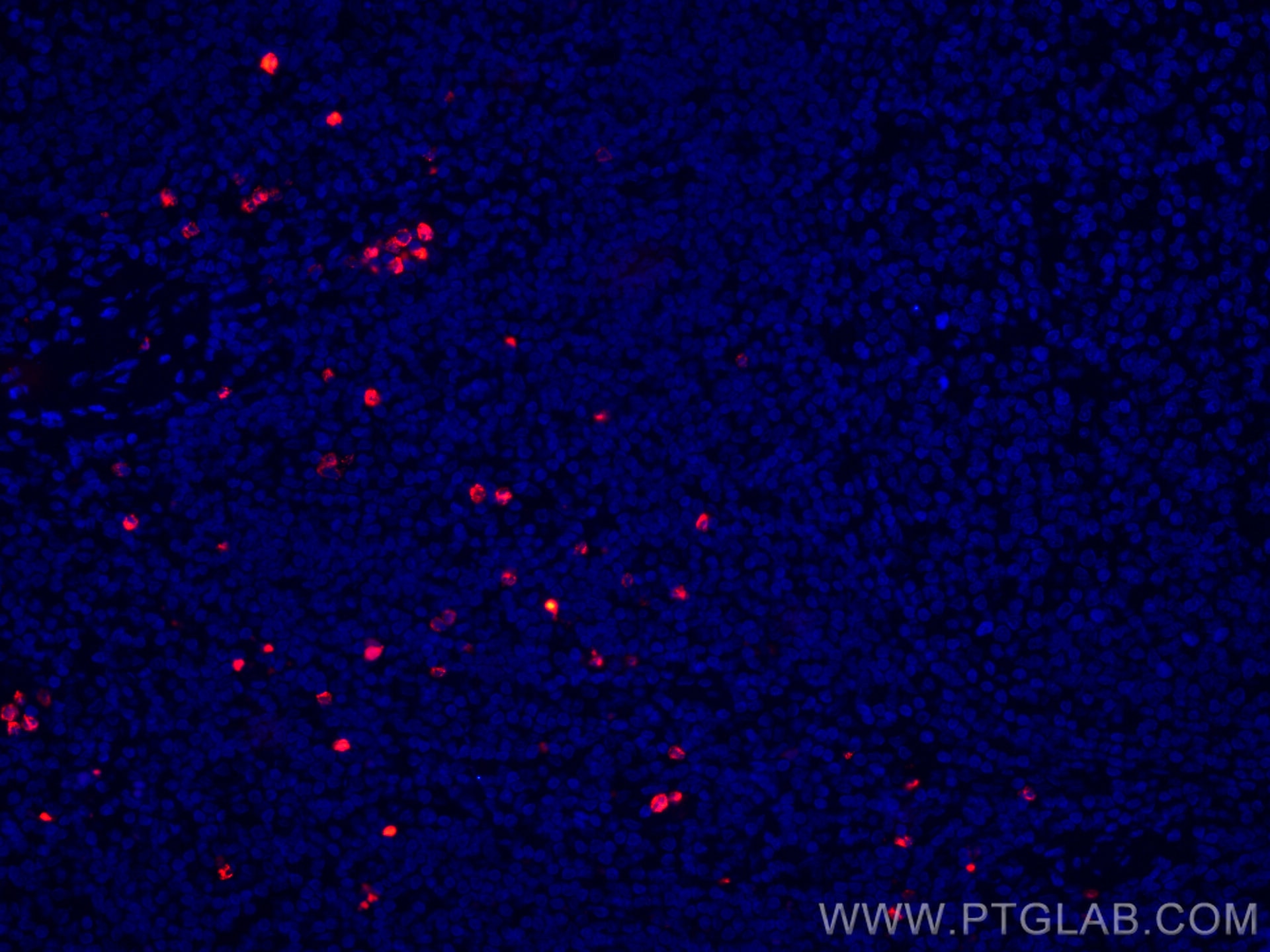 Immunofluorescence (IF) / fluorescent staining of human tonsillitis tissue using CoraLite®594-conjugated PRTN3 Monoclonal antibody (CL594-67030)