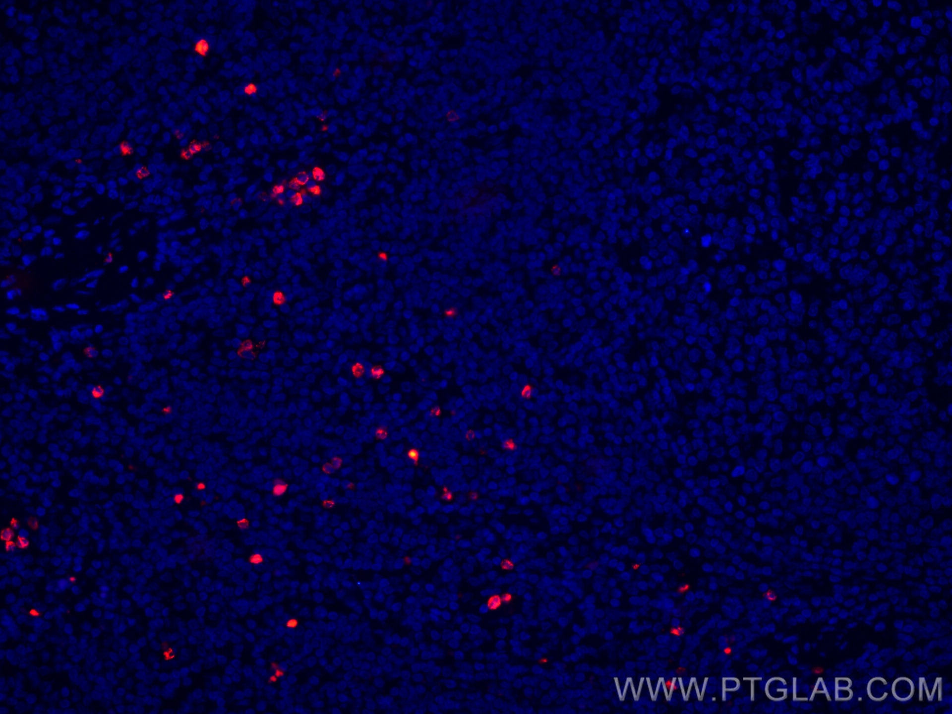 IF Staining of human tonsillitis using CL594-67030