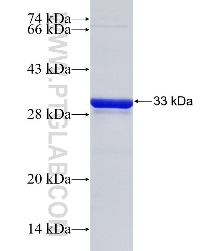 PRTN3 fusion protein Ag25915 SDS-PAGE