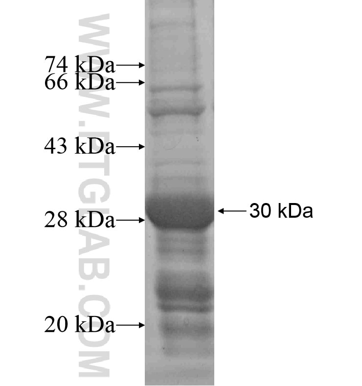PRTN3 fusion protein Ag16765 SDS-PAGE