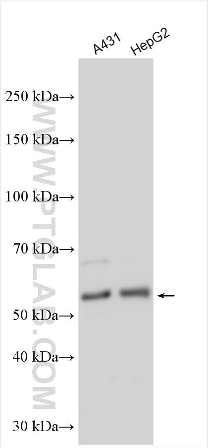 Western Blot (WB) analysis of various lysates using PRUNE Polyclonal antibody (18537-1-AP)