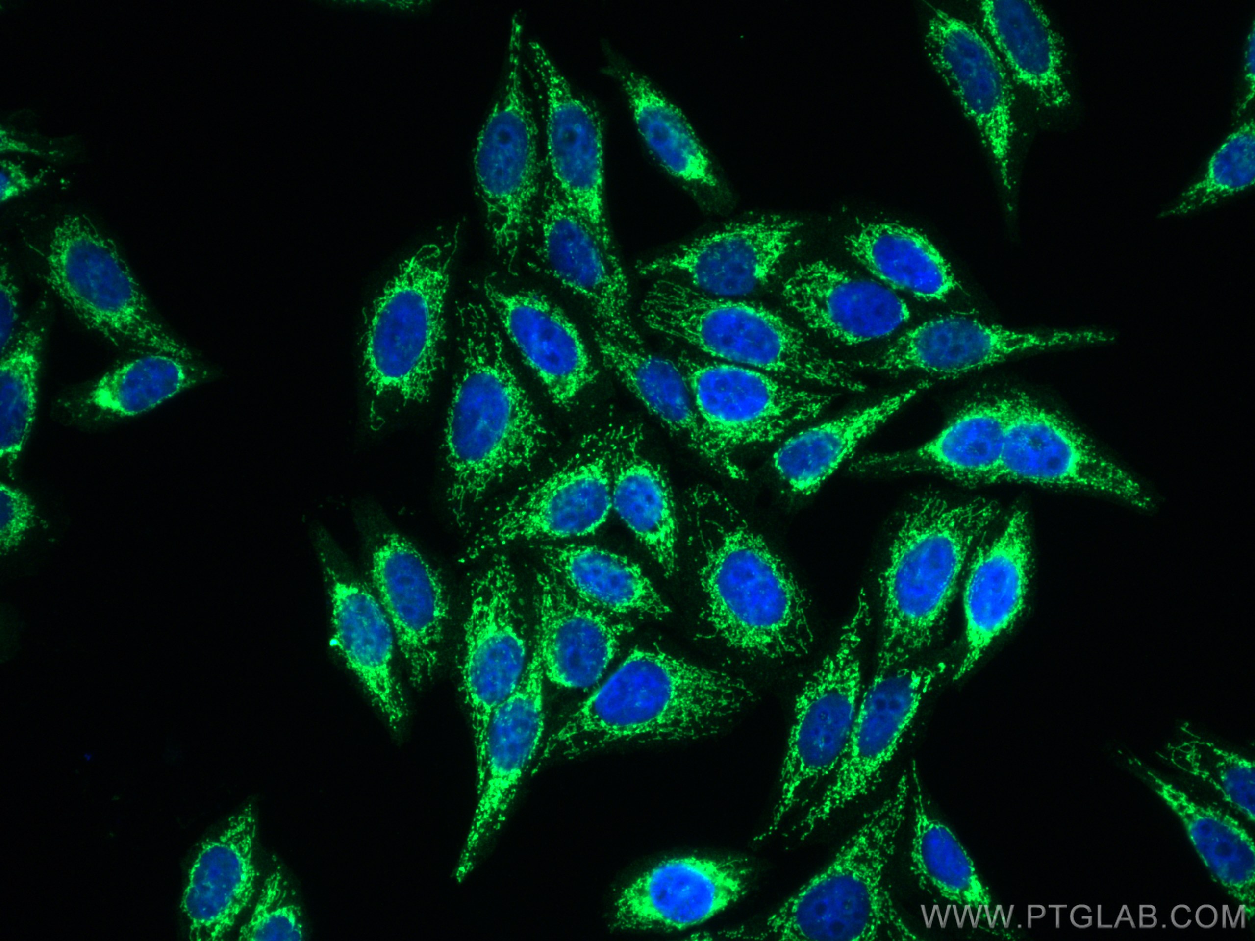 Immunofluorescence (IF) / fluorescent staining of HepG2 cells using PRDX3 Polyclonal antibody (10664-1-AP)