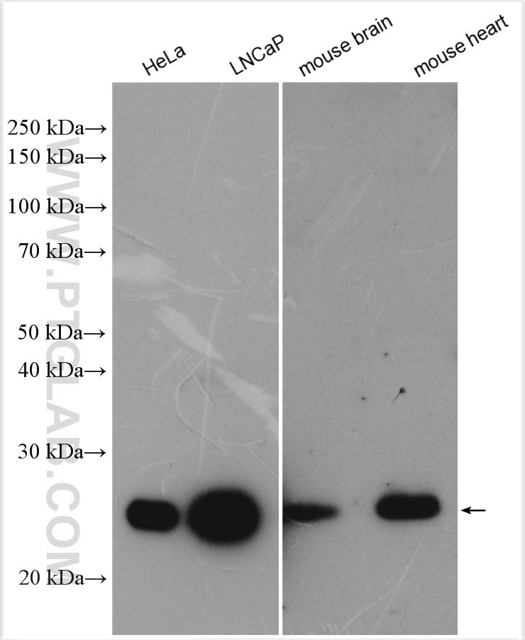 Western Blot (WB) analysis of various lysates using PRDX3 Polyclonal antibody (10664-1-AP)