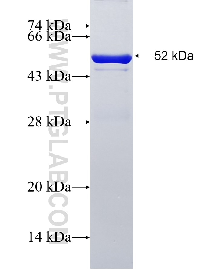 PRX3 fusion protein Ag1062 SDS-PAGE