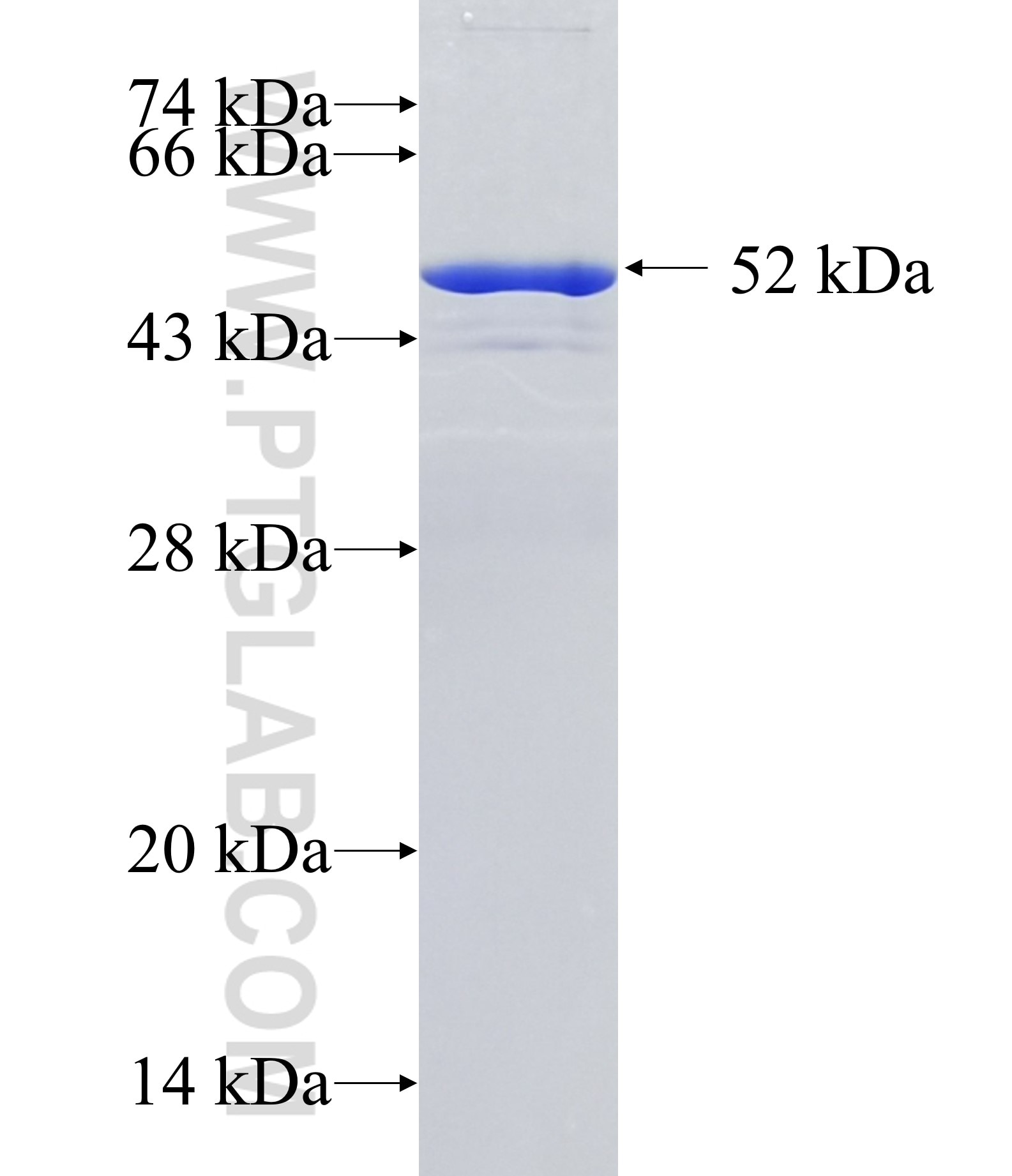 PRX3 fusion protein Ag1062 SDS-PAGE