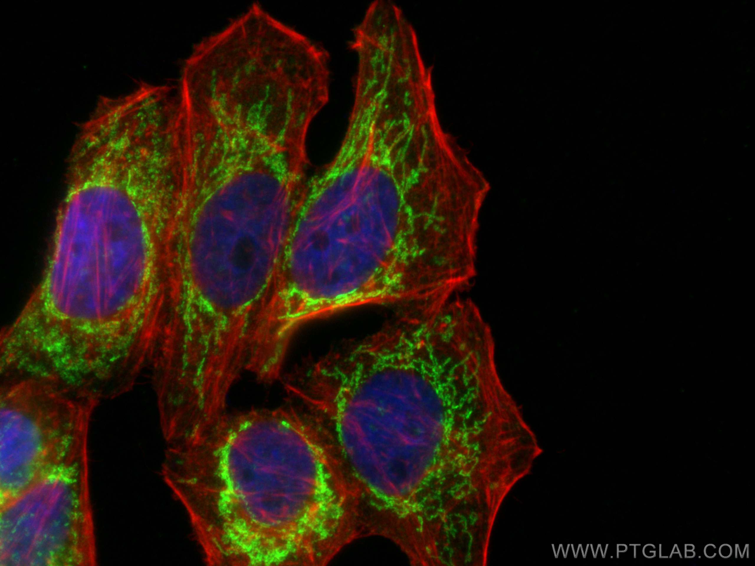 IF Staining of HepG2 using 81833-1-RR