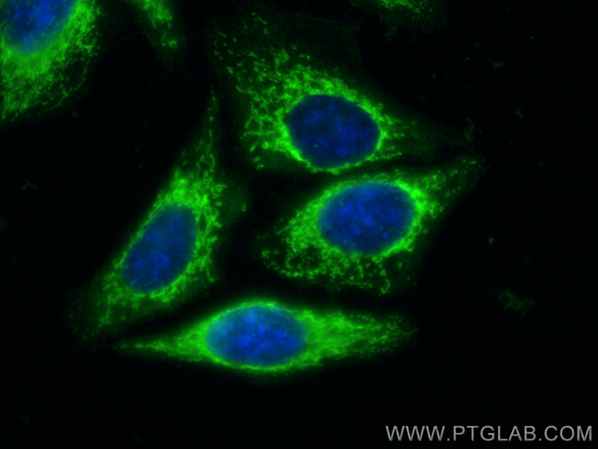 IF Staining of HepG2 using 81833-1-RR