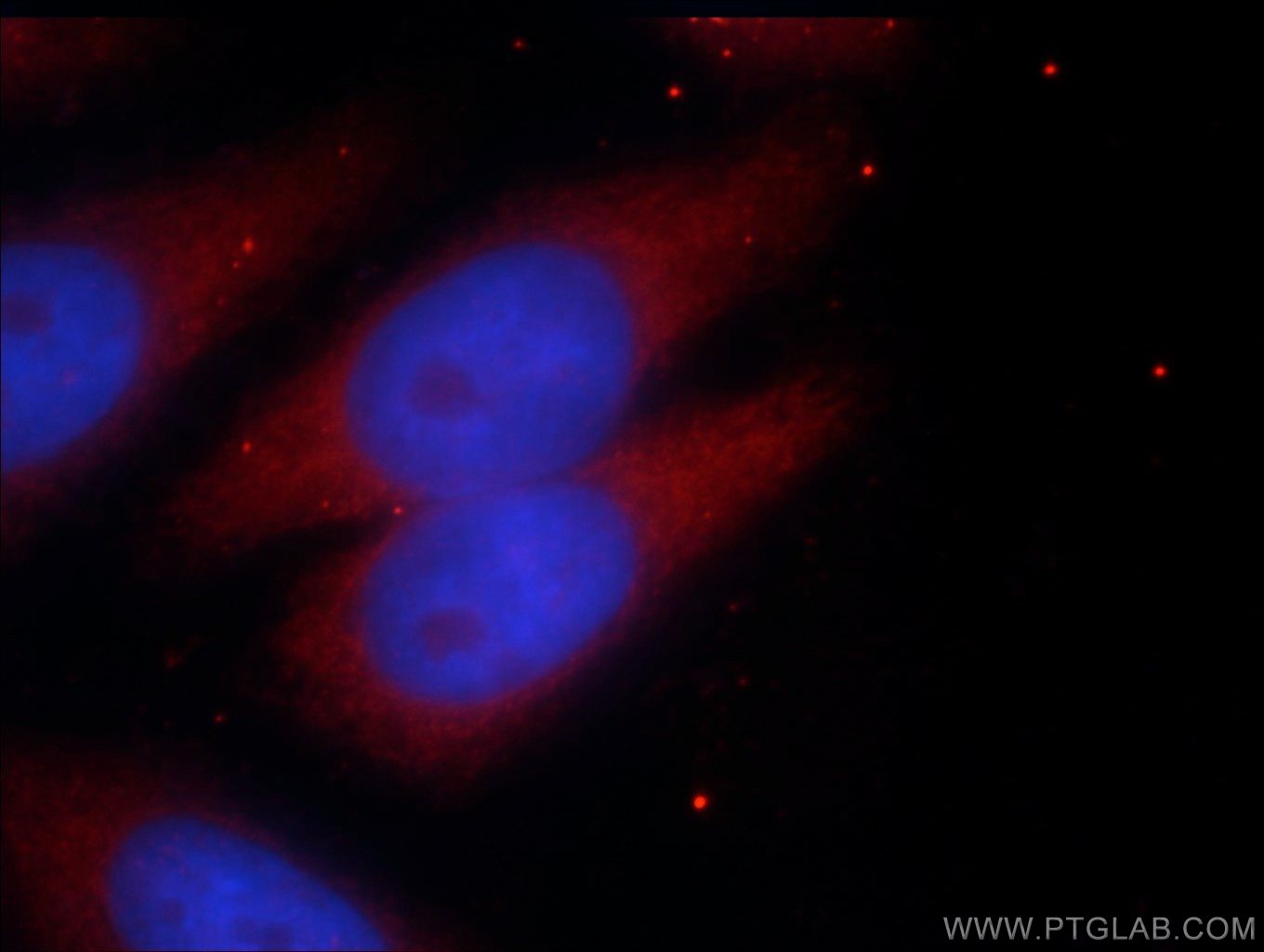 Immunofluorescence (IF) / fluorescent staining of HepG2 cells using PRY Polyclonal antibody (24688-1-AP)
