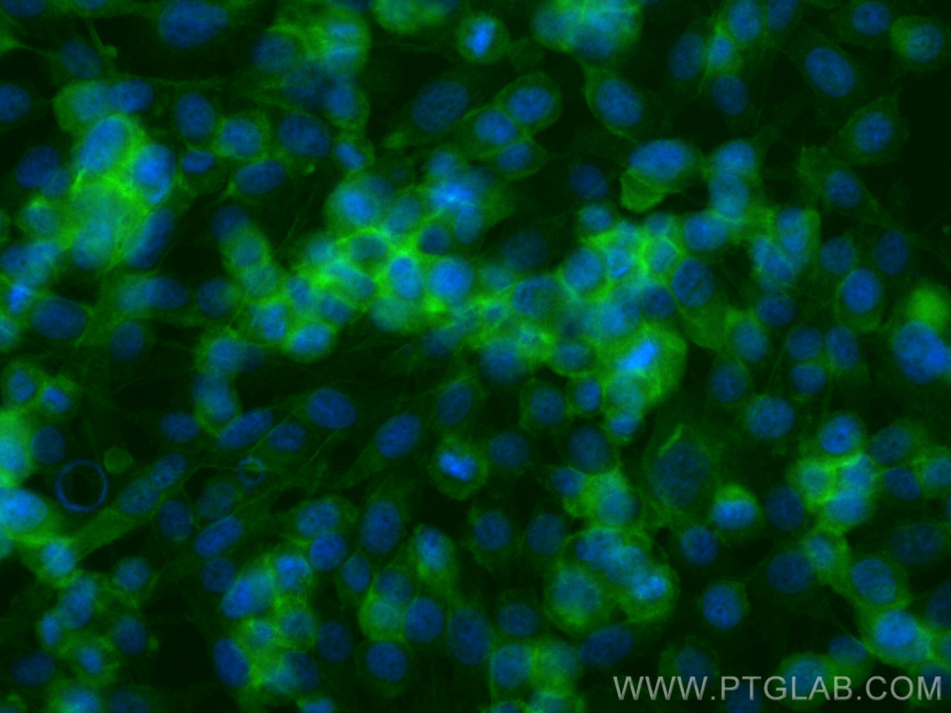 Immunofluorescence (IF) / fluorescent staining of PC-3 cells using PRY Polyclonal antibody (24688-1-AP)