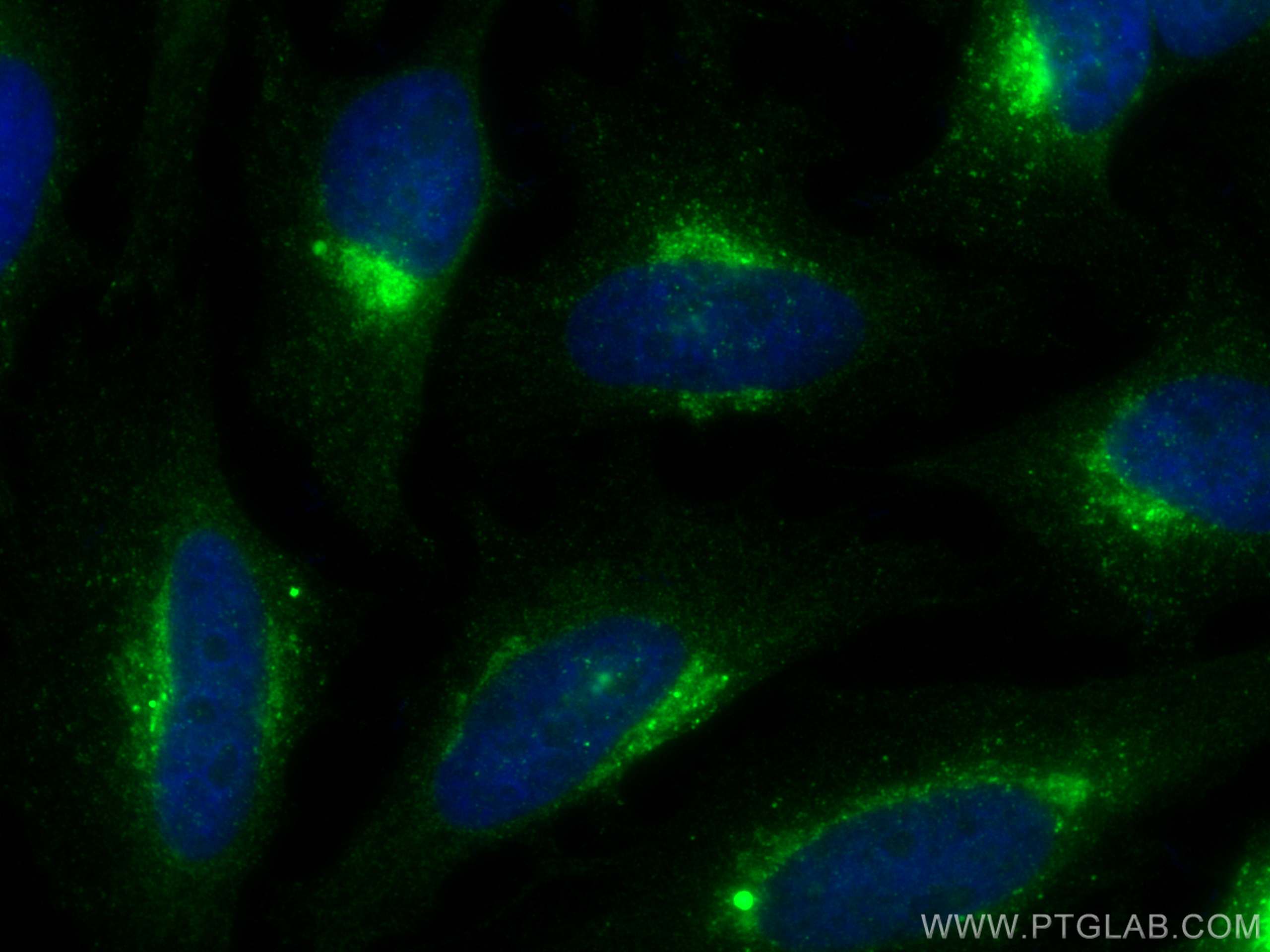 Immunofluorescence (IF) / fluorescent staining of HeLa cells using PSAP Polyclonal antibody (10801-1-AP)